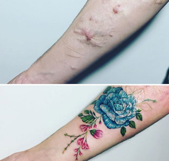 Когда шрам становится украшением: 50 великолепных татуировок