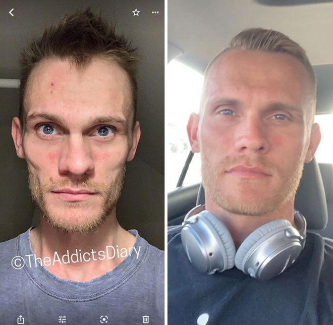 До и после: 10 фотоисторий людей, которые прекратили принимать наркотики