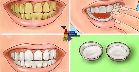 Гарантировано! Отбеливайте желтые зубы менее, чем за 2 минуты!