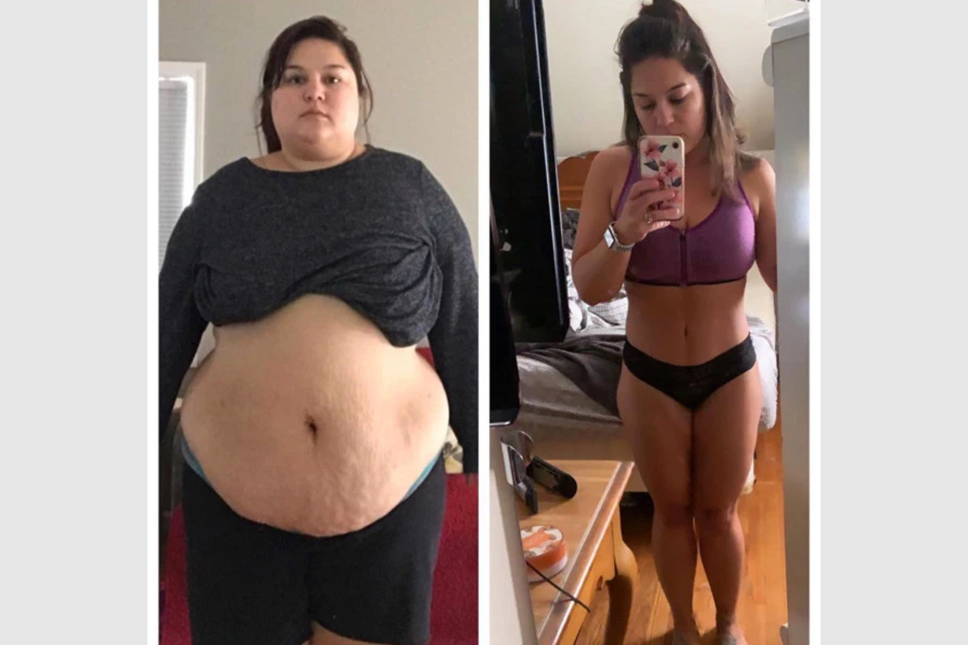 Страдающие лишним весом. Похудение до и после. Женщина с лишним весом.
