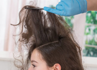 Педикулез: описание, симптомы, лечение и профилактика Педикулез: описание, симптомы, лечение и профилактика