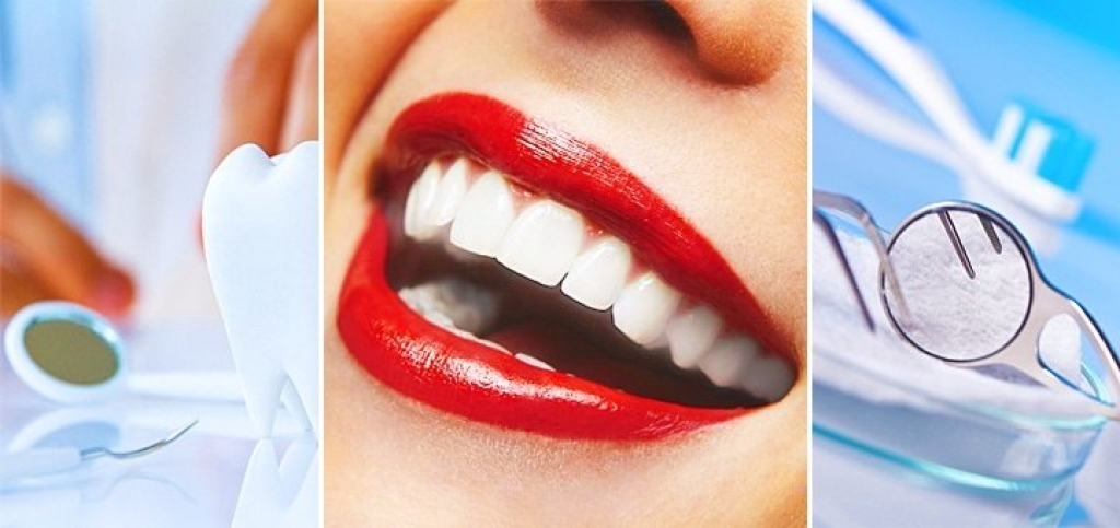Помимо эстетики: зачем отбеливать зубы?