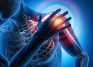 Какие вопросы возникают об остеопорозе чаще всего? Какие вопросы возникают об остеопорозе чаще всего?