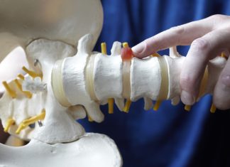 Лечение грыжи позвоночника без операции Как лечить позвоночную грыжу?