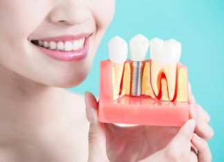 5 веских причин посетить стоматологическую клинику Татьяны Коновой прямо сейчас 5 веских причин посетить стоматологическую клинику Татьяны Коновой прямо сейчас