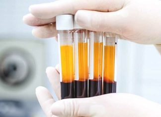 PRP терапия и Plasmolifting®: особенность проведения процедуры